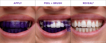 Brillianz Smile Dry Purple Instant Whitening Strips
